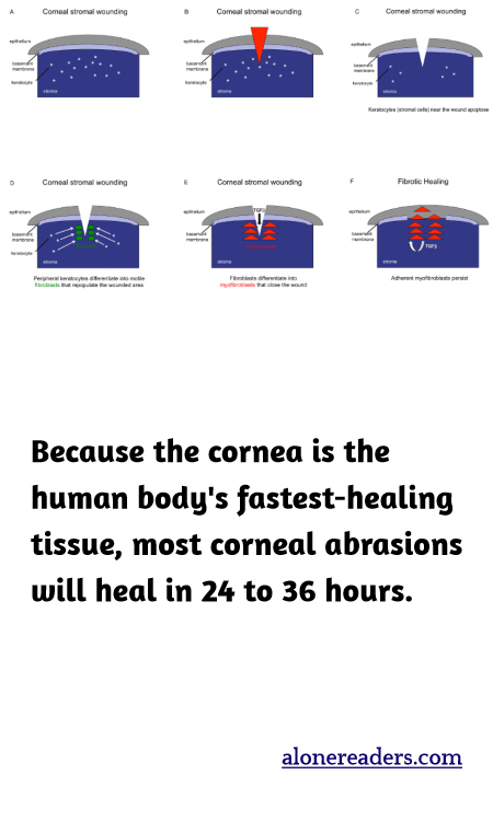 Because the cornea is the human body's fastest-healing tissue, most corneal abrasions will heal in 24 to 36 hours.