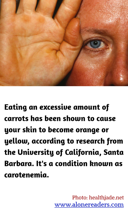 Eating an excessive amount of carrots has been shown to cause your skin to become orange or yellow, according to research from the University of California, Santa Barbara. It's a condition known as carotenemia.