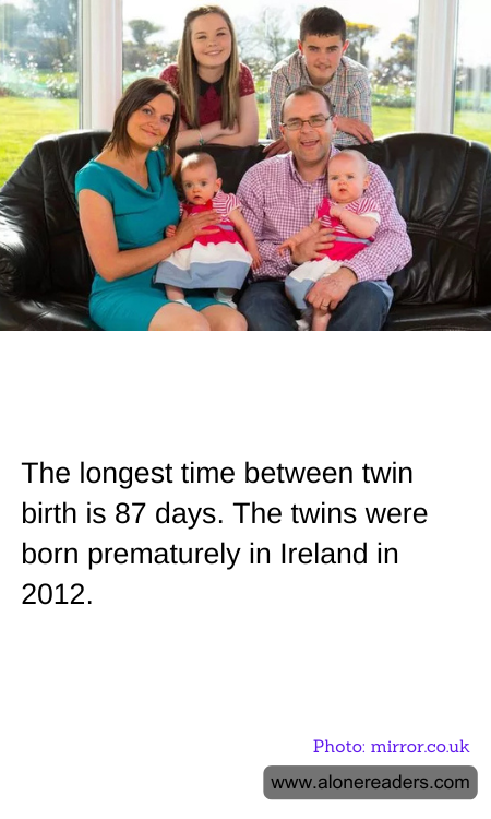 The longest time between twin birth is 87 days. The twins were born prematurely in Ireland in 2012.