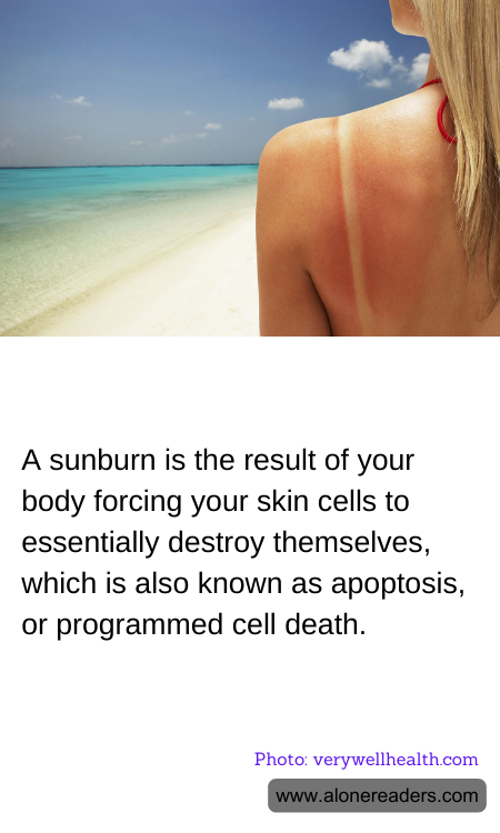 A sunburn is the result of your body forcing your skin cells to essentially destroy themselves, which is also known as apoptosis, or programmed cell death.