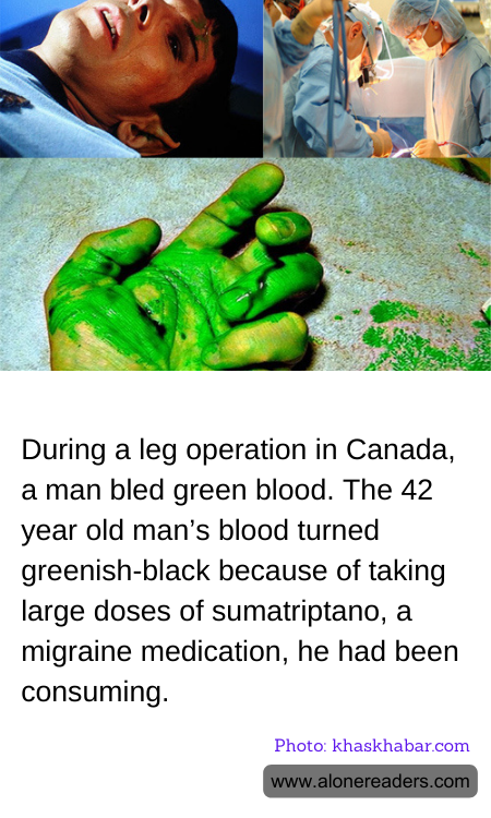 During a leg operation in Canada, a man bled green blood. The 42 year old man’s blood turned greenish-black because of taking large doses of sumatriptano, a migraine medication, he had been consuming.