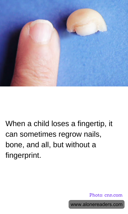 When a child loses a fingertip, it can sometimes regrow nails, bone, and all, but without a fingerprint.