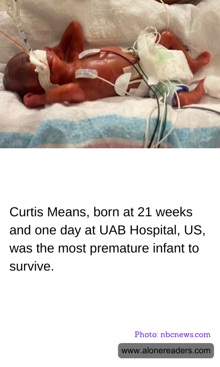 Curtis Means, born at 21 weeks and one day at UAB Hospital, US, was the most premature infant to survive.