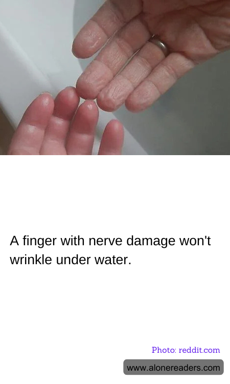 A finger with nerve damage won't wrinkle under water.
