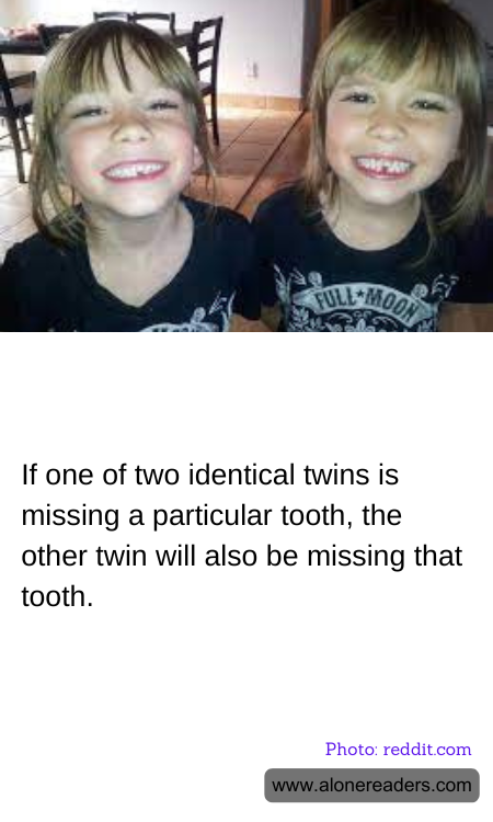 If one of two identical twins is missing a particular tooth, the other twin will also be missing that tooth.
