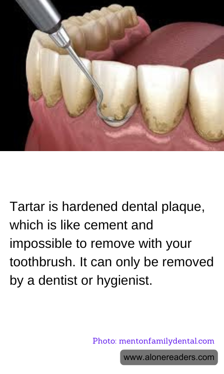 Tartar is hardened dental plaque, which is like cement and impossible to remove with your toothbrush. It can only be removed by a dentist or hygienist.