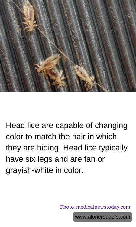 Head lice are capable of changing color to match the hair in which they are hiding. Head lice typically have six legs and are tan or grayish-white in color.