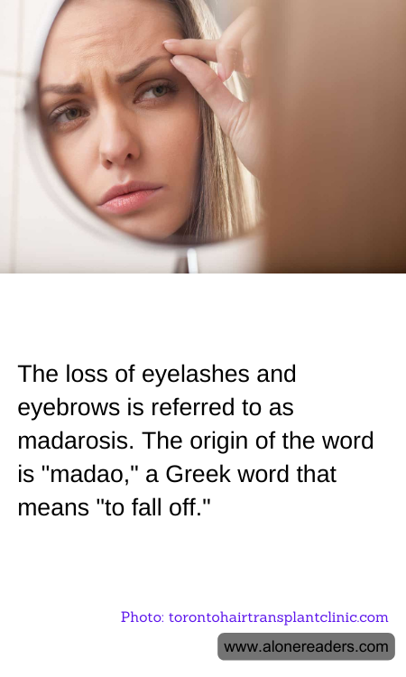 The loss of eyelashes and eyebrows is referred to as madarosis. The origin of the word is "madao," a Greek word that means "to fall off."