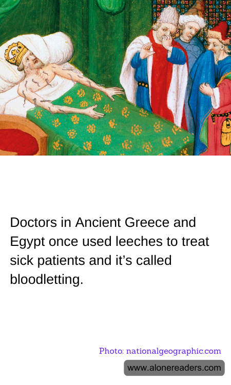 Doctors in Ancient Greece and Egypt once used leeches to treat sick patients and it’s called bloodletting.